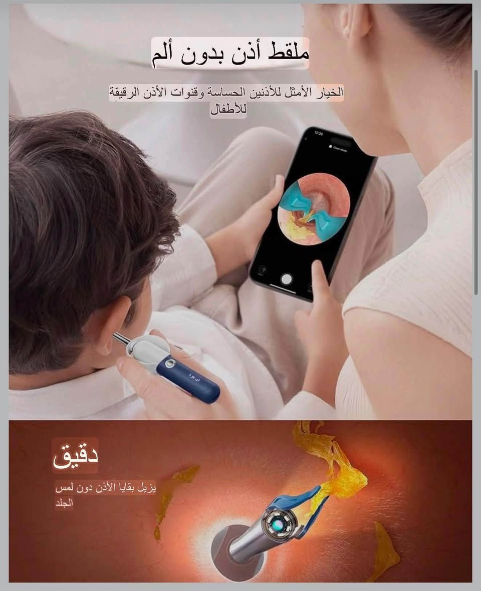 جهاز تنظيف الاذن الاحترافي ماركة bebird توفر💐
 
كاميرا Bebird Earsight Plus R37R لإزالة شمع الأذن، منتجات مؤهلة لبرنامج FSA HSA، 
منظف أذن ذكي مع ملاقط بصرية غير مؤلمة، 
منظار أذن مرن مزود بكاميرا، 
طقم تنظيف منزلي للأنف والأذن والحنجرة للعائلة، 

كاميرا تنظيف الأذن الذكية المصممة خصيصًا لأذنيك: ليست كل كاميرات الأذن متساوية! تم تصميم منظار الأذن الرقمي المرن والقابل للطي ليناسب الانحناءات الطبيعية لقناة أذنك، مما يجعل الفحص والتنظيف أسهل من أي وقت مضى. بالإضافة إلى ذلك، مع كاميرا عالية الدقة مقاومة للماء والغبار والضباب بتقنية 3P، ستحصل على رؤية داخلية مذهلة!

السلامة والراحة التامة: السلامة أولًا! يضمن الطلاء السيليكوني الناعم عدم وجود خدوش أو إزعاج، وتبقى رؤوس التنظيف ثابتة في مكانها أثناء الاستخدام - لا داعي للقلق بشأن سقوطها. يمنع مقياس الأمان المدمج والسدادة الواقية الإدخال الزائد، مما يحافظ على سلامة طبلة أذنك أثناء التنظيف.

ملقط أذن مزود بكاميرا بدون ألم: يزيل هذا الملقط المرئي الدقيق المزود بكاميرا شمع الأذن بلطف دون لمس قناة الأذن، مما يجعله مثاليًا للأذنين الحساسة أو الأذنين الصغيرتين الرقيقتين. إذا كنت ترغب في تنظيف لطيف وغير مؤلم، فإن ملقط الأذن المزود بكاميرا هو الحل الأمثل.

مجموعة تنظيف الأذن المثالية: مجموعة متكاملة للاستخدام المنزلي والسفر! مع 4 أنواع من رؤوس التنظيف المتينة، تُعدّ مثالية للأذنين الرطبة والجافة، مما يضمن تنظيفًا شاملاً في كل مرة. بالإضافة إلى ذلك، تتضمن المجموعة أدوات فحص الأذن والأنف والحنجرة، مما يجعل الفحوصات المنزلية سهلة للغاية، ويوفر عليك المال والجهد. علبة التخزين المدمجة مثالية للسفر - خذها معك أينما ذهبت!

تنظيف الأذن بطريقة ممتعة: إنها ليست مجرد أداة تنظيف - إنها ممتعة للغاية! سيستمتع الكبار براحة تنظيف شمع الأذن، بينما سينبهر الأطفال ولن يخشوا العناية بأذنهم بعد الآن. إنها ممتعة لجميع أفراد العائلة!

جديدة 👍
السعر ٤٠ الف 💐

🥀تابع الصفحة ليصلك كل جديد🥀

للحجز والاستفسار المراسلة بالخاص او رقم واتساب ***********💐

نص مكتوب في الصور:
- منظار الأذن المرن يناسب بشكل أفضل قم بثنيه وتشكيله يناسب قناة أذنك يوفر رؤية فائقة الوضوح مقاوم للماء. مقاوم للغبار. مقاوم للضباب عدسات بصرية ثلاثية الطبقات لرؤية أكثر وضوحا
- ملقط أذن بدون ألم الخيار الأمثل للأذنين الحساسة وقنوات الأذن الرقيقة للأطفال دقيق يزيل بقايا الأذن دون لمس الجلد
- نظافة الأذن بنسبة تصل إلى 100% احرص دائما على تنظيف أذنيك بشكل صحيح! ملقط إزالة شمع الأذن العنيد مغرفة إزالة شمع الأذن العادي مكشطة استخراج الشوائب إسفنجة إزالة شمع الأذن الرطب
- مثالي للكبار والصغار
- انظر بوضوح، نظف بثقة!
- تنظيف ذاتي
- للأطفال
- للأزواج
- مستلزمات الفحص المنزلي افحص آذان وأنف وأسنان وحلق أطفالك فحص الأذن فحص الأنف فحص الفم