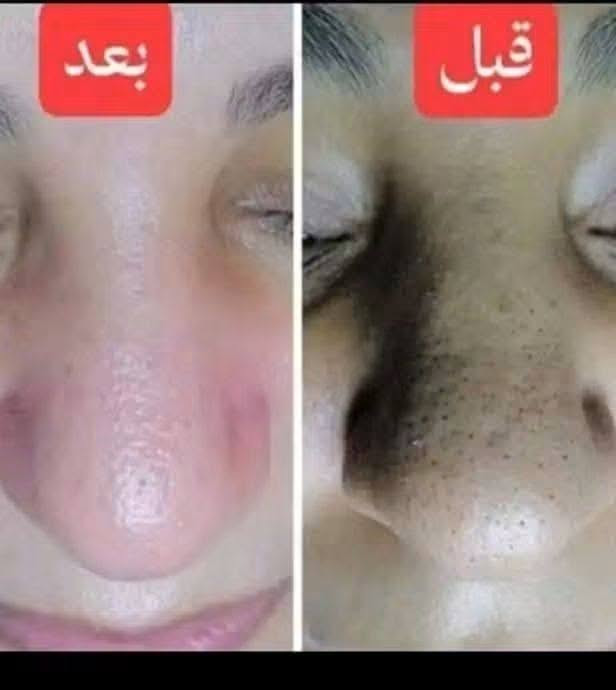 شيره جسم • ثقب أذن • خدمه منزليه