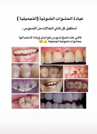 علاج مجاني • حشوات ضوئية • بغداد شارع فلسطين