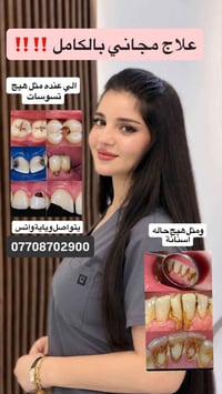علاج مجاني • تسوسات • اسنان