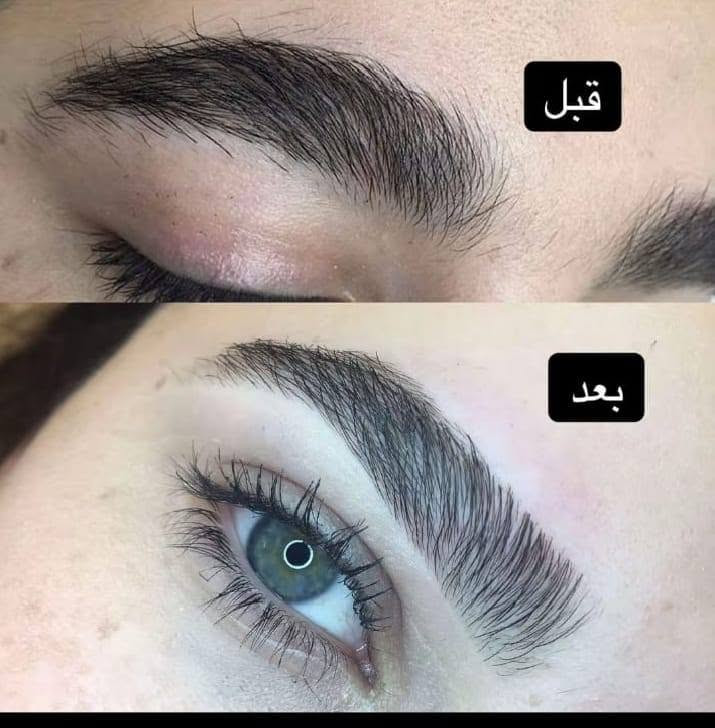 صالون ام مريم للسيدات حفافه تنظيف بشره صبغ شعر تسريح تنظيف قدم  مكياج مناسبات  اكرلك مواد تجميل مقشرات للبشره ولجسم. العنوان المفرق قرب جامع أسماء الله الحسنى مجاور مدرسة الابداع الاهليه. رقم هاتف. ***********

نص مكتوب في الصور:
- قبل
- بعد