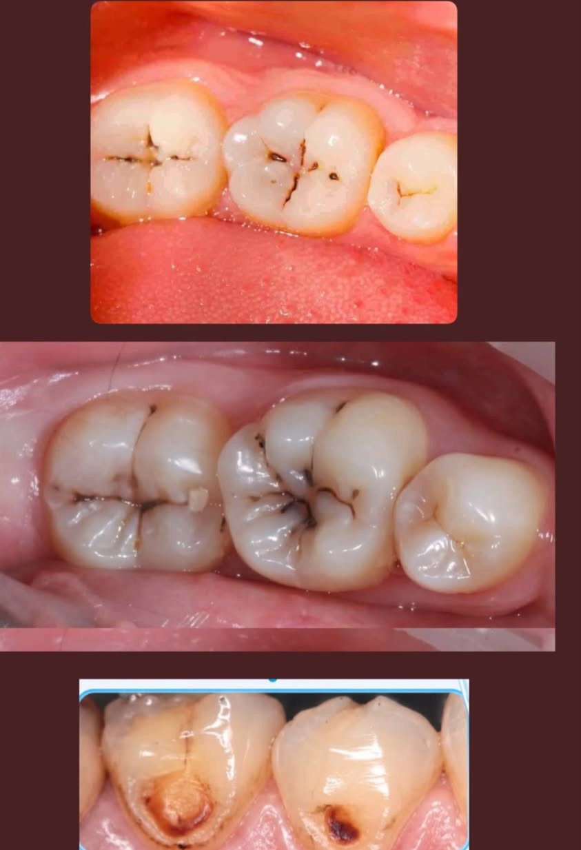 علاج اسنان مجانا تحت اشراف دكاترة مختصين
للاستفسار واتساب ***********
كربلاء الموظفين قرب مستشفى الولادة

نص مكتوب في الصور:
- مجانااﺍ