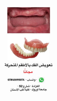 تعويض الفك • أطقم متحركة • الكرادة