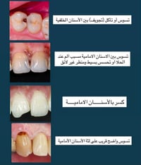 علاج أسنان • مجاني • الناصرية