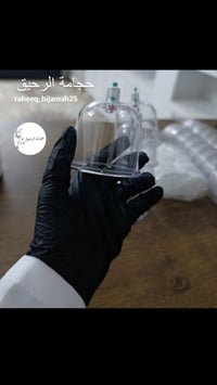 عرض خاص • حجامة • ١٧ ربيع الأول