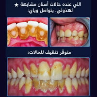 علاج مجاني • أسنان • السيدية بغداد