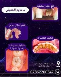 مجاني • طقم أسنان جزئي • قلع جذور