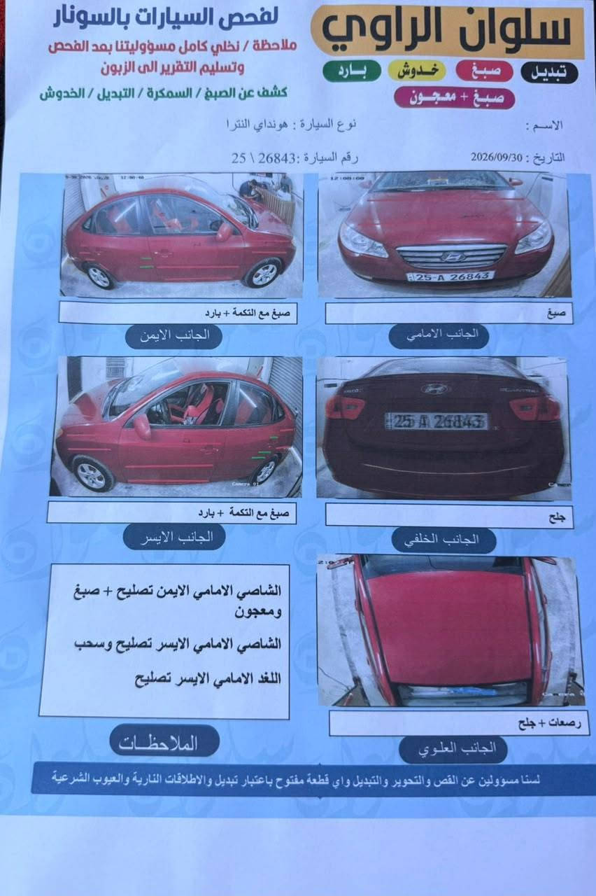 النترا ٢٠٠٧ • محرك ٢٠٠٠ • رقم كركوك
