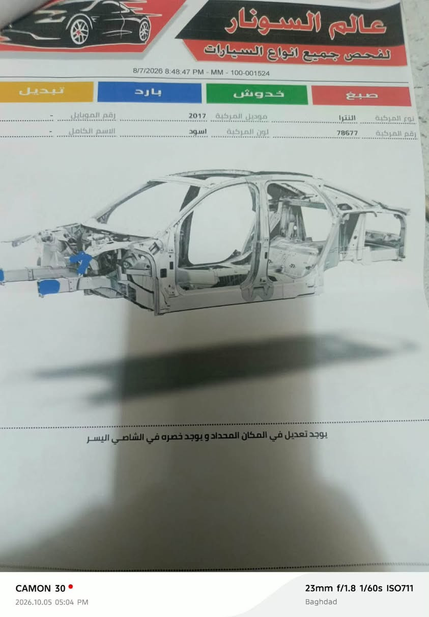 النترا 2017 • وارد امريكي • محرك تعبان