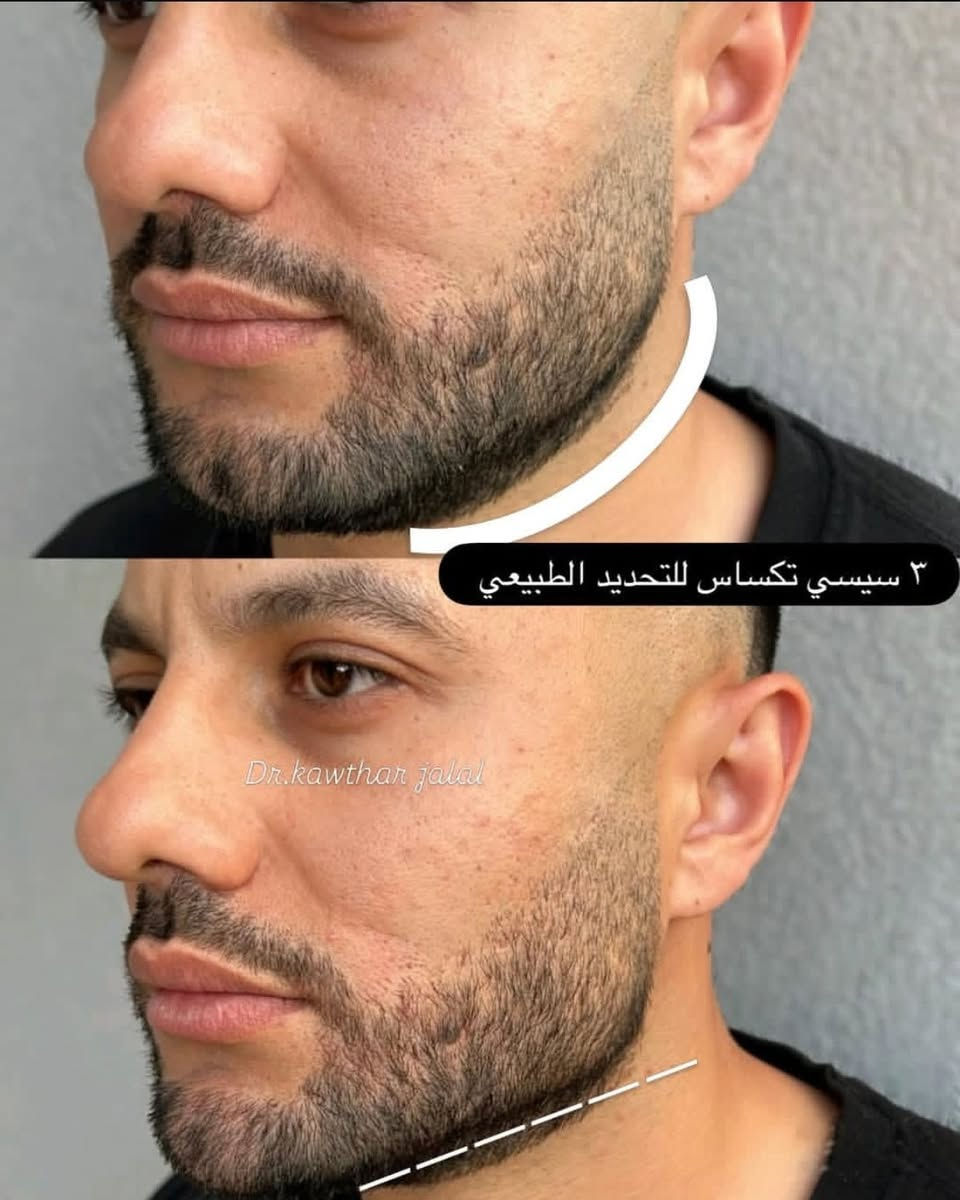 ​✨ ابتسامتك وجمالك… يكتملون في عيادة أوريليا! ✨
كل ما تحتاجه لابتسامة ساحرة وإطلالة مشرقة بمكان واحد، بإشراف أطباء اختصاص وبـ أنسب الأسعار ونتائج مضمونة 💎
​🦷 خدمات طب وتجميل الأسنان:
​ابتسامة هوليوود، تبييض ليزري، حشوات تجميلية، وزراعة وتقويم بأحدث الأجهزة وبدون ألم.
​💉 قسم التجميل اللاجراحي:
​حقن الفلر، البوتوكس، جلسات النضارة والبروفايلو لإطلالة طبيعية وشابة.
​📍 العنوان: بغداد - الغزالية - شارع البدالة - مجاور مكوى الغزالية
​📞 للحجز والاستفسار: *********** دكتورة كوثر 
​عيادة أوريليا.. لأنك تستحق الإطلالة الأفضل! ✨
