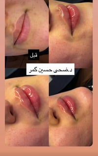 عيادة مون لايت • د ضحى حسين • رسمة وجه