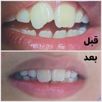 متواجدين يوميا من الساعه الرابعه عصرا  للحجز 07782419354