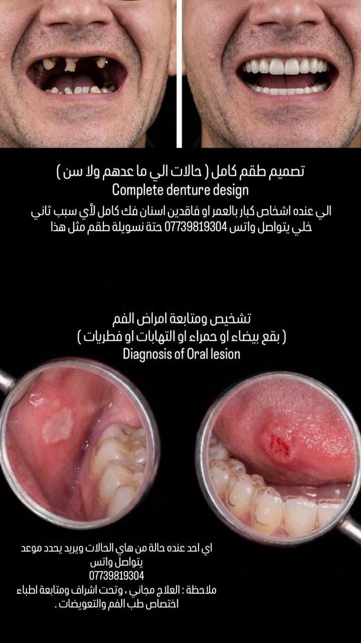 المنصور • جامعة التراث • العلاج مجاني