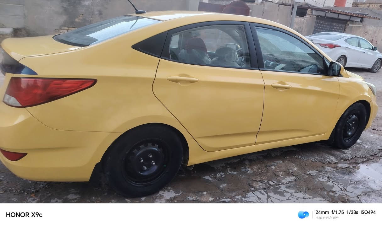سلام عليكم اكسن2016 امريكي ليبل واحد فقط رقم بغداد جاملغ السايق وخشم بنيد مكينه 600 حداديه تبريد تدفئه مكينه كير سنويه ال 2031 بسمي هزه جديده مداور ثاني يوم سعر 80 مجال قليل  مكلف بل نشر مكلف بل نشر ***********
