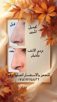 ترميم الانف • تجميل • بلفيلر
