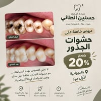 حشوات الجذور • الديوانية • خصم ٢٠٪