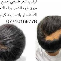 لا توجد تفاصيل  نص مكتوب في الصور: - تركيب شعر طبيعي لجميع انواع حروق ...