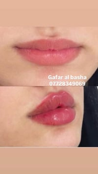 فيلر • بشرة • العماره مغربه