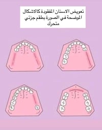 علاج مجاني • قلع وتنظيف وحشوات • الدورة جامعة الهادي