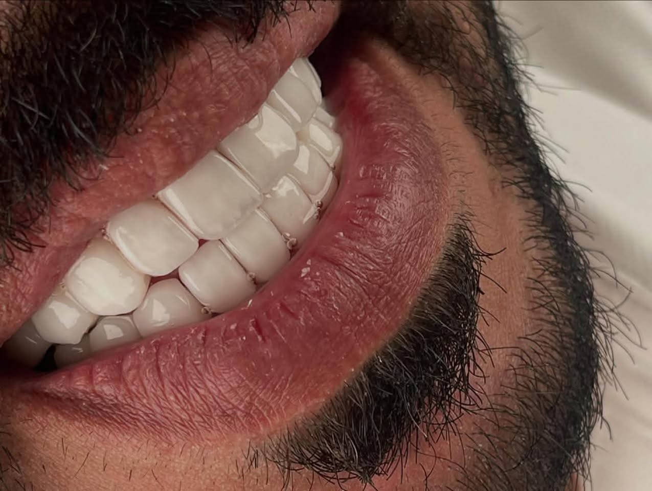 لأن ابتسامتك هي أول ما يلاحظه الآخرون، ومنها تبدأ ثقتك بنفسك 😍

متواجدين طيلة ايام الاسبوع
  نستقبلكم بكل حُب♥️
العنوان : الديوانية/ تحت الجسر المعلق / بناية فندق الديوانية سابقًا / مقابل المحافظة

للحجز والاستفسار 
***********
***********⁩
