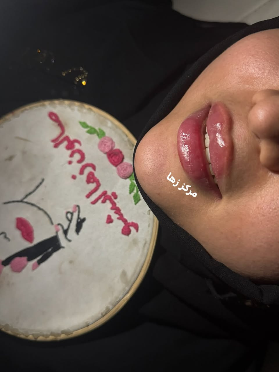 جمال فلر سويسري ولمعته ادمان 😍
مو ماده فروله طريه تجنن 

للاستفسار والحجز واتساب 
***********

ادمونه زهراء

نص مكتوب في الصور:
- مرکز زهرا
- مركز زها
