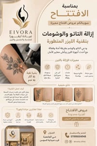 إزالة تاتو بالليزر • عروض افتتاح • حي الجامعة