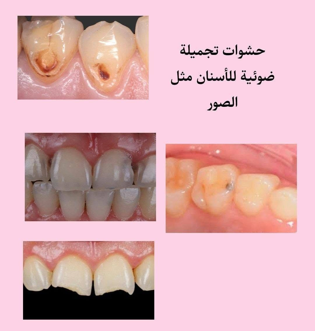 علاج مجاني • جامعة البيان • طب أسنان