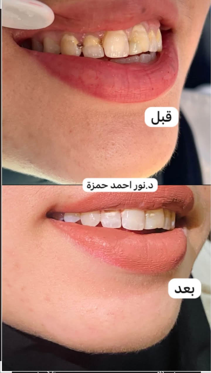 خدمات أسنان مجانية • تقويم متحرك • حله شارع ٤٠
