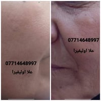 بكج العنبر • علا اوليفيرا • زيت شعر