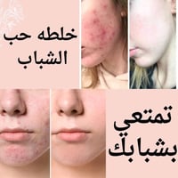 بشرة أصغر • شد الترهلات • كرت ضمان
