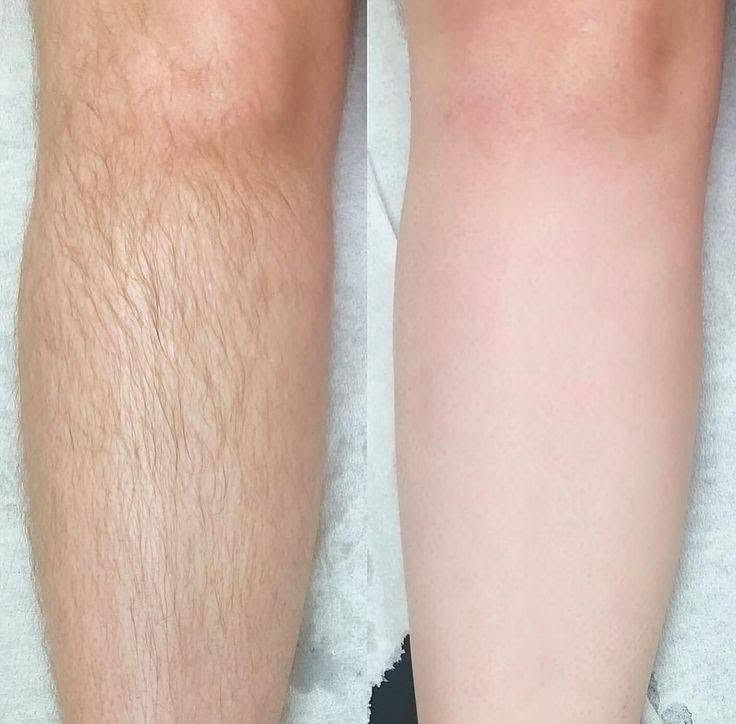 لأن جمالج يستاهل العناية ✨
تنظيف بشرة 🤍 | تنظيف جسم ✨ | بشيرة 🌸 | حفافة الوجه 🌷 | تنظيف القدمين 🦶🏻
دلّلي نفسج وخلي العناية والجمال بإيد خبيرة البشرة سجى 💕
📞 للحجز والاستفسار: ***********
مواعيدج تنتظرج… احجزي هسه وخلي فرق العناية يبين عليج
