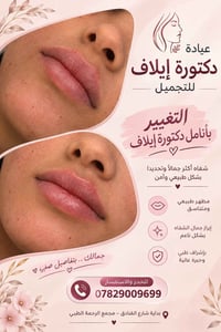 عيادة إيلاف • تجميل شفاه • شارع الفنادق