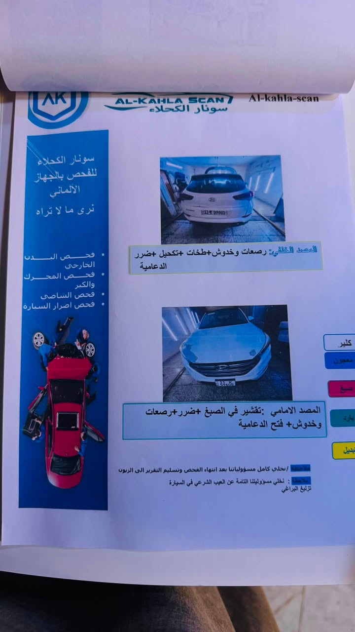 السلام عليكم توسان2018 خليجي بانوراما حساس خلفي  اشارةبالمرايةوشفط لد امامي السيارةمحرك وكيرعلى وضع الشركةومكفولةمن الصبغ بها ملاحظات واضحةبالسونار ماشية219@ السعر158 ومجال بسيط 
بغدادحي الاعلام *********** واتس اب فقط
