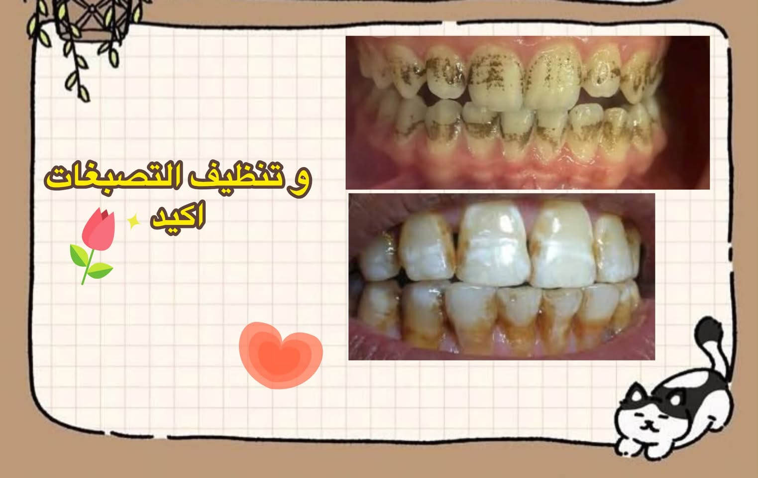 اهتموا بابتسامتكم، والبداية من صحة أسنانكم 🦷✨
تتوفر خدمات علاجية متنوعة ضمن العيادات
الجامعية، منها:
حشوات الأسنان
اقلع الجذور
ا تنظيف التكلسات ا
أطقم الأسنان
(العلاج يتم داخل العيادات الجامعية وتحت إشراف)
الكادر المختص.
للتفاصيل والاستفسار، التواصل عبر الرقم / واتساب
+964 789 158 6853
***********

نص مكتوب في الصور:
- الحالات اللي نستقبله
- التسوسات العاديه
- السن انكسر وضل عندك جذر متبقي
- قبل بعد في حال انكم فاقدين اسنان وتريدون تعوضوهن بطقم جزئي مثل هالحاله
- و تنظيف التصبغات اكيد