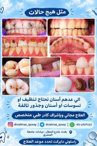 علاج اسنان مجاني • تنظيف اسنان • عيادات جامعة المشرق