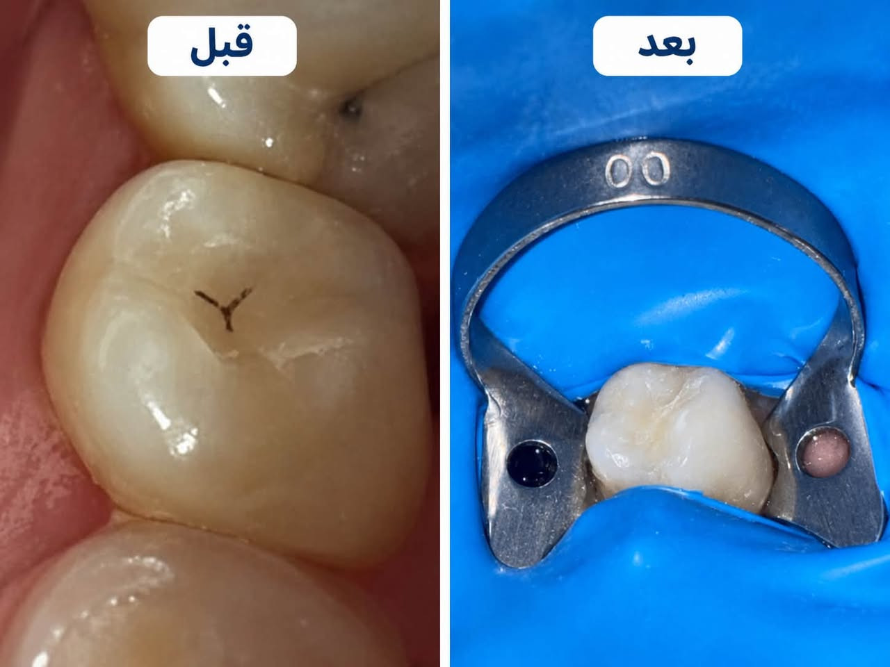 مجانا • تنظيف اسنان • الكرادة