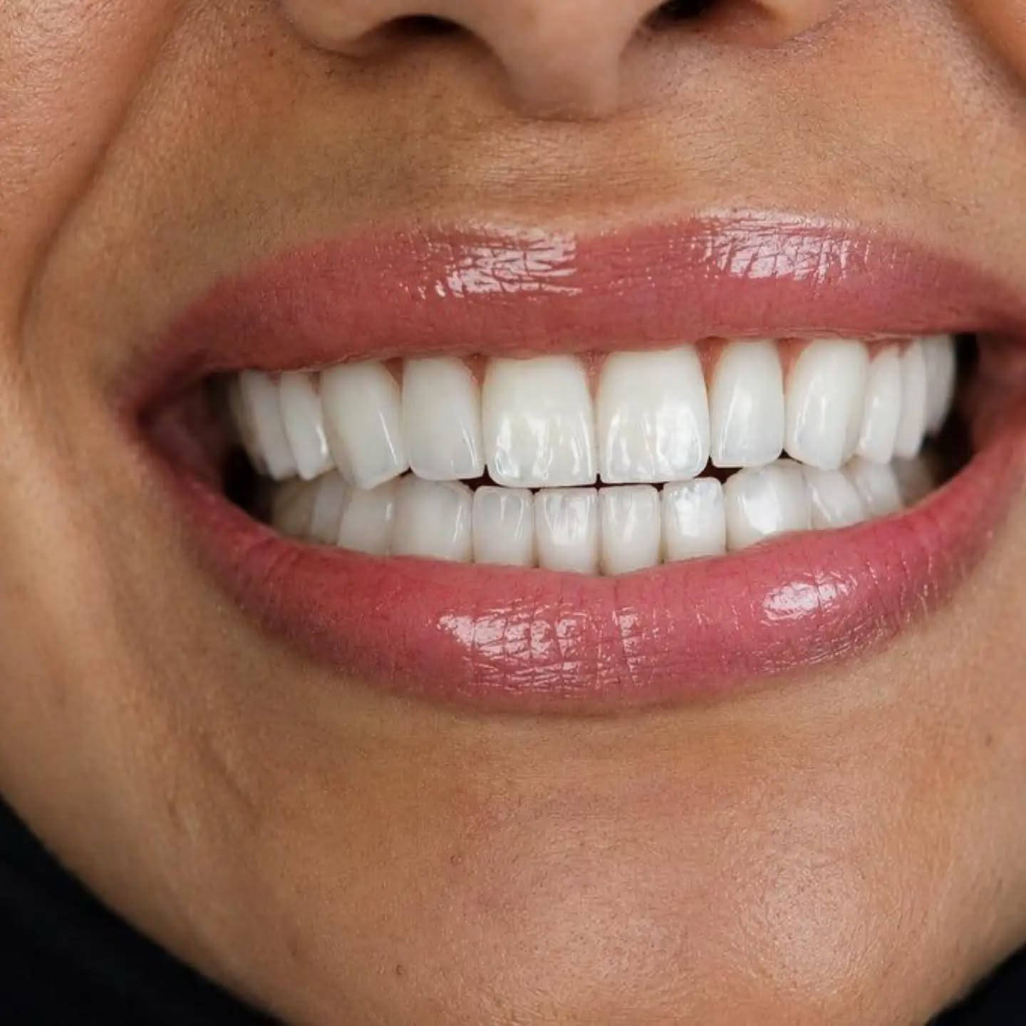 ✨ ابتسامتچ تستاهل تكون أجمل! ✨

تجميل الأسنان مو بس يغيّر شكل الأسنان، إنما يمنحچ ابتسامة مرتبة وثقة أكبر بنفسچ 🤍🦷

🌸 تصميم ابتسامة يناسب ملامحچ
✨ تحسين شكل ولون الأسنان
🦷 نتائج طبيعية وأنيقة
💎 اهتمام بأدق التفاصيل

📍 مركز سما المناذرة لطب الأسنان
خلي ابتسامتچ تحچي عن جمالچ 🤍

العنوان / النجف الاشرف _ المناذرة _ الشارع العام _ قرب مستشفى
 المناذرة _عمارة الحاج ابو نبيل جانب صيدلية الأصالة
 للحجز والأستفسار  / ***********
الساعه 8:00 صباحا الساعه 12:00 ظهرا من الساعه 3:00 ظهرا الى الساعه 9:00 ليلا ًَ
