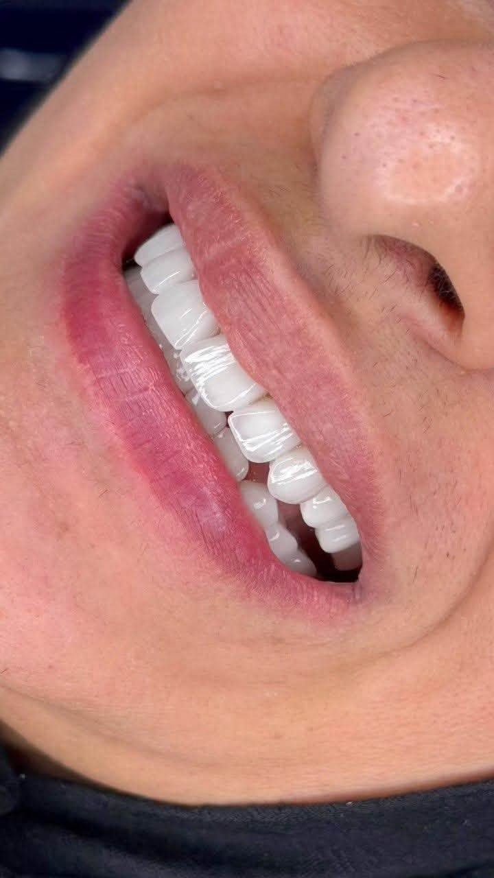 مركز ماسة • تجميل أسنان • الحسينية شارع ٢٠