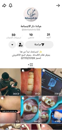 عيادة دار الابتسامة • تخدير الالكتروني • تبيض بليزر