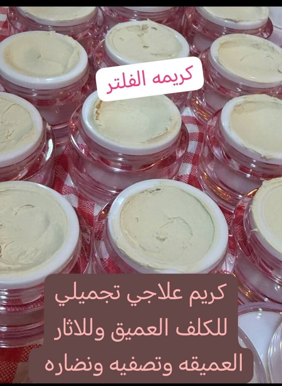 توفرت كريمه سنوايت💕
وكريمة الفلتر للكلف العميق 💕
رهيباتتت يعالجن التصبغات والكلف من اول اسبوع 💞

للحجز والاستفسار يرجى مراسله الصفحه
رقم هاتف واتساب ***********
توصيل بسماية 1000
بغداد 5000
محافضات 6000
يوجد دفع عن طريق الماستر كارد ✅💵
