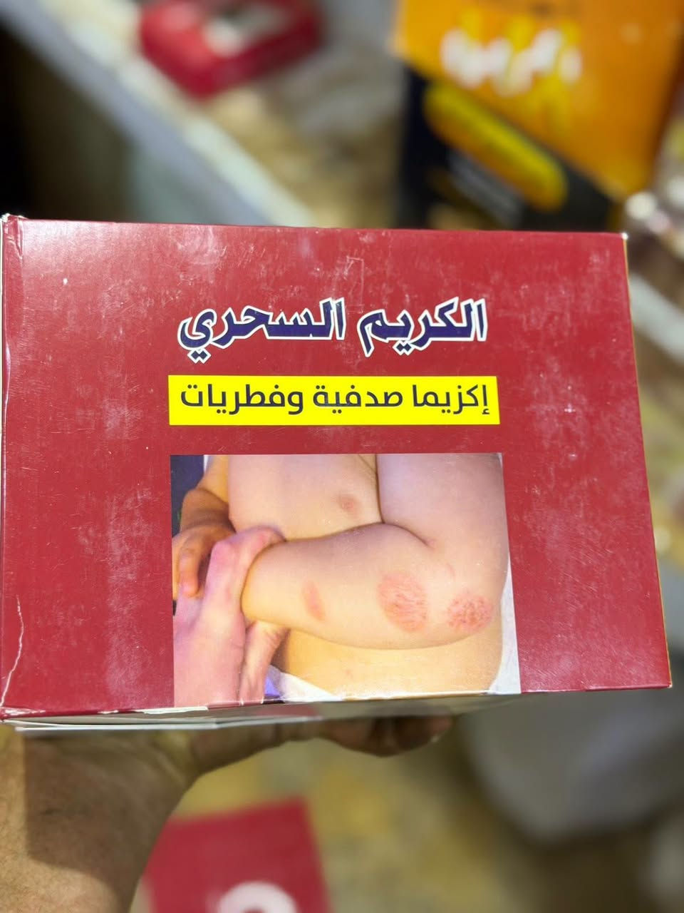 لا توجد تفاصيل

نص مكتوب في الصور:
- PROPOLEO Fresh هو بخاخ معطر ومنعش للفم بالعسل وعكبر النحل (البروبوليس) مكتوب عليه بالعربي: "معطر منعش للفم بالعسل وعكبر النحل" هذا المنتج كلش مشهور بالعراق ومحلات العطاريات، ينباع كبديل طبيعي لبخاخات النفس الصناعية. شنو بيه؟ عسل - معروف بخصائصه + Propolis المادة الأساسية: عكبر النحل المطهرة ومضاد للبكتيريا والالتهاب. النكهات اللي تجي بالعلبة مثل ما واضح بالصورة: 1. Lemon - ليمون 2. Liquorice - عرق سوس 3. Cinnamon - دارسين / قرفة 4. Fruit - فواكه مشكلة (رمان وفواكه) 5. Strawberries - فراولة 6. Mint - نعناع (اللي طالع بالصورة). العلبة الكبيرة تحتوي عادة 12 حبة بخاخ صغير، كل بخاخ ينحط بالجيب. طريقة الاستعمال بخة او بختين مباشرة بالفم، ينعش النفس فوراً ويترك طعم حلو. يستعملوه لازالة رائحة الفم. لترطيب الحلق والتدخين. متوفر لدى عطارية الحاج محسن الزبيدي ميسان | سوق الكروش - عطارية الحاج محسن الزبيدي للاستفسار والحجز *********** واتساب
- اللي بالصورة هو كريم صدفية مشهور جداً في الأسواق. - بالصيني: 银屑修护膏 يعني "مرهم ترميم الصدفية" - بالعربي: كريم الصدفية - بالروسي: Крем от псориаза = كريم ضد الصدفية - الوزن: Net: 30g - الشركة: ZHONGJING و TIANGE 田歌 INDUSTRIAL هذا النوع من الكريمات يباع على أنه "اعشاب طبيعية صينية" لكن فحوصات مخبرية في بريطانيا وأمريكا لكريمات مشابهة جداً له مثل Zudaifu و Yiganerjing أظهرت أنها تحتوي على كلوبيتازول بروبيونات clobetasol propionate وهو كورتيزون قوي جداً من الدرجة الأولى، ولا يصرف إلا بوصفة طبية. كلوبيتازول يستخدم للصدفية المتوسطة إلى الشديدة، لكن العلاج به لا يجب أن يتجاوز أسبوعين ولا أكثر من 50غ في الأسبوع لأنه كورتيزون فائق الفعالية متوفر لدى عطارية الحاج محسن الزبيدي ميسان | سوق الكروش - عطارية الحاج محسن الزبيدي الاستفسار والحجز *********** واتساب