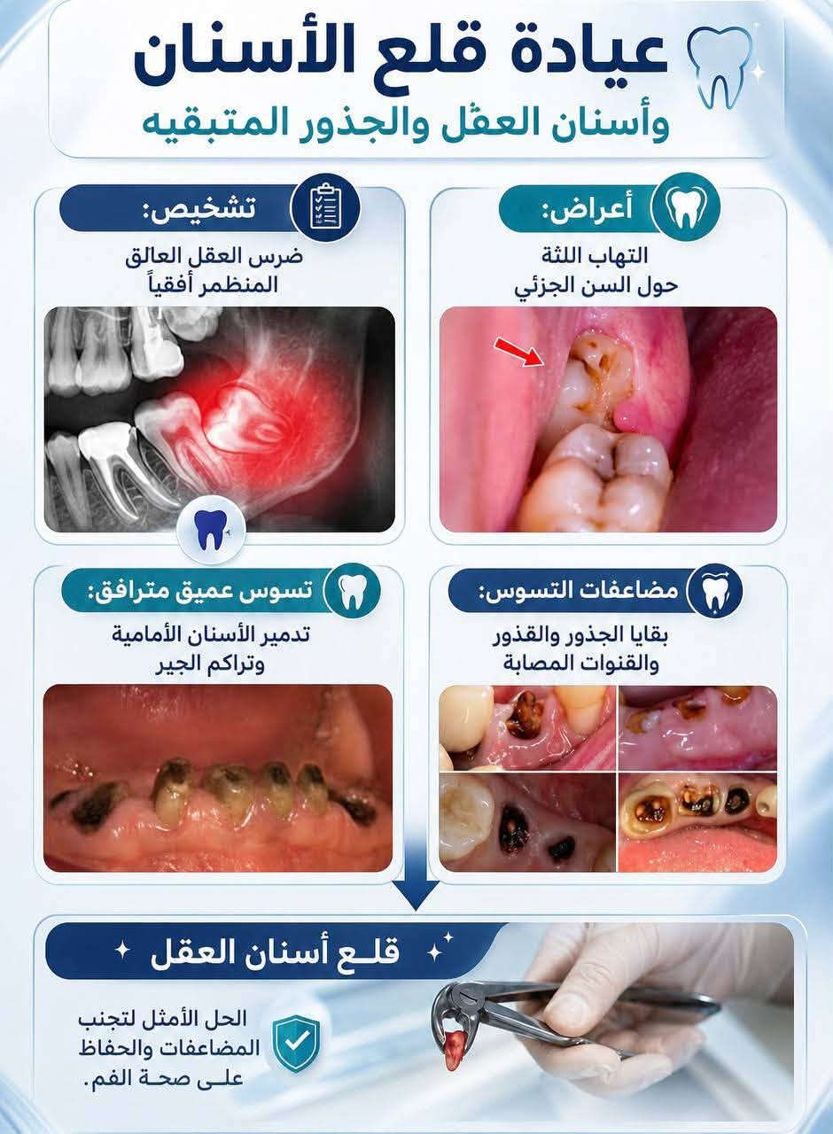 جامعة البيان • علاج مجاني • حشوات ضوئية