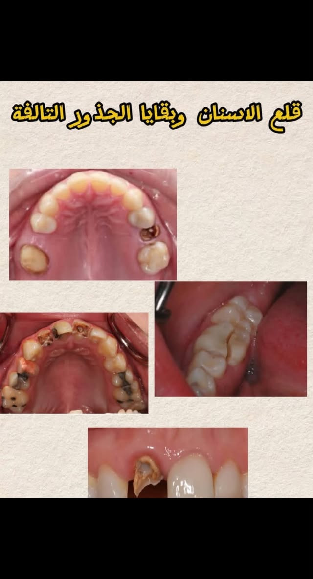 كلية طب الأسنان • خدمات مجانية • تنظيف أسنان