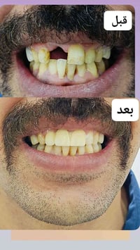 صيدلية محمود مفكر • شارع ٦٠ • قبل وبعد