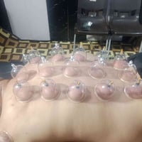 حجامة • تدليك • شارع المستشفئ