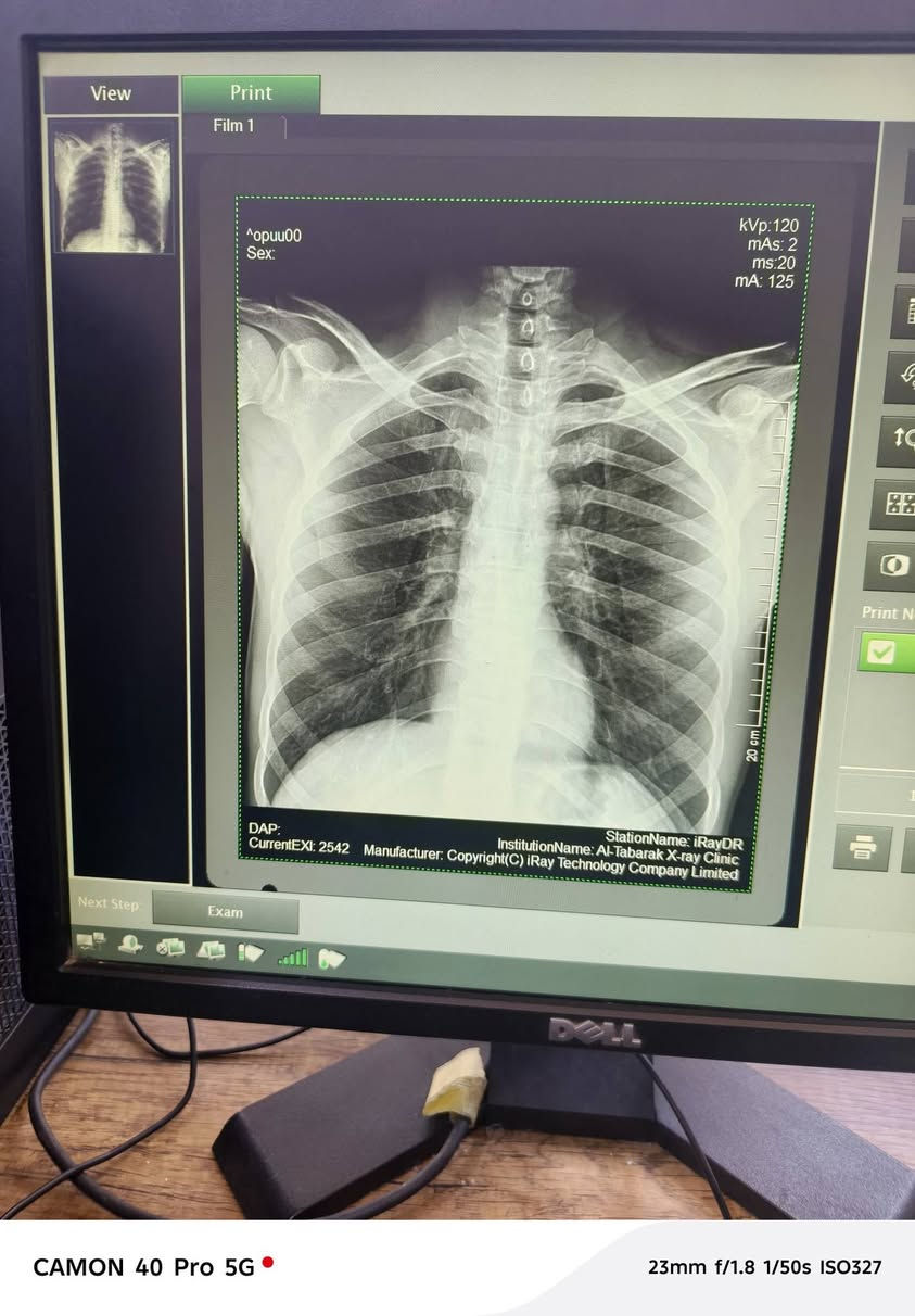 عياده التبارك 
للاشعه العاديه والملونه🩻👨🏻‍⚕️
الموقع الشرقاط
شارع الاطباء مجمع الماس الطبي بين عياده الدكتور عبد الرزاق الترف ولدكتور زين العابدين
📍رقم الهاتف ***********

