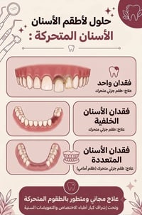 مجاني • طقم اسنان متحرك
