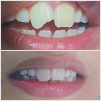 عيادة اصلان • أسنان • تجميل
