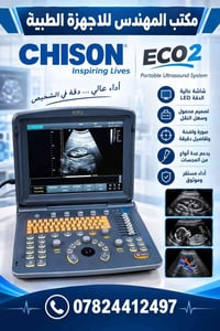 سونار محمول • CHISON ECO2 • دقة عالية