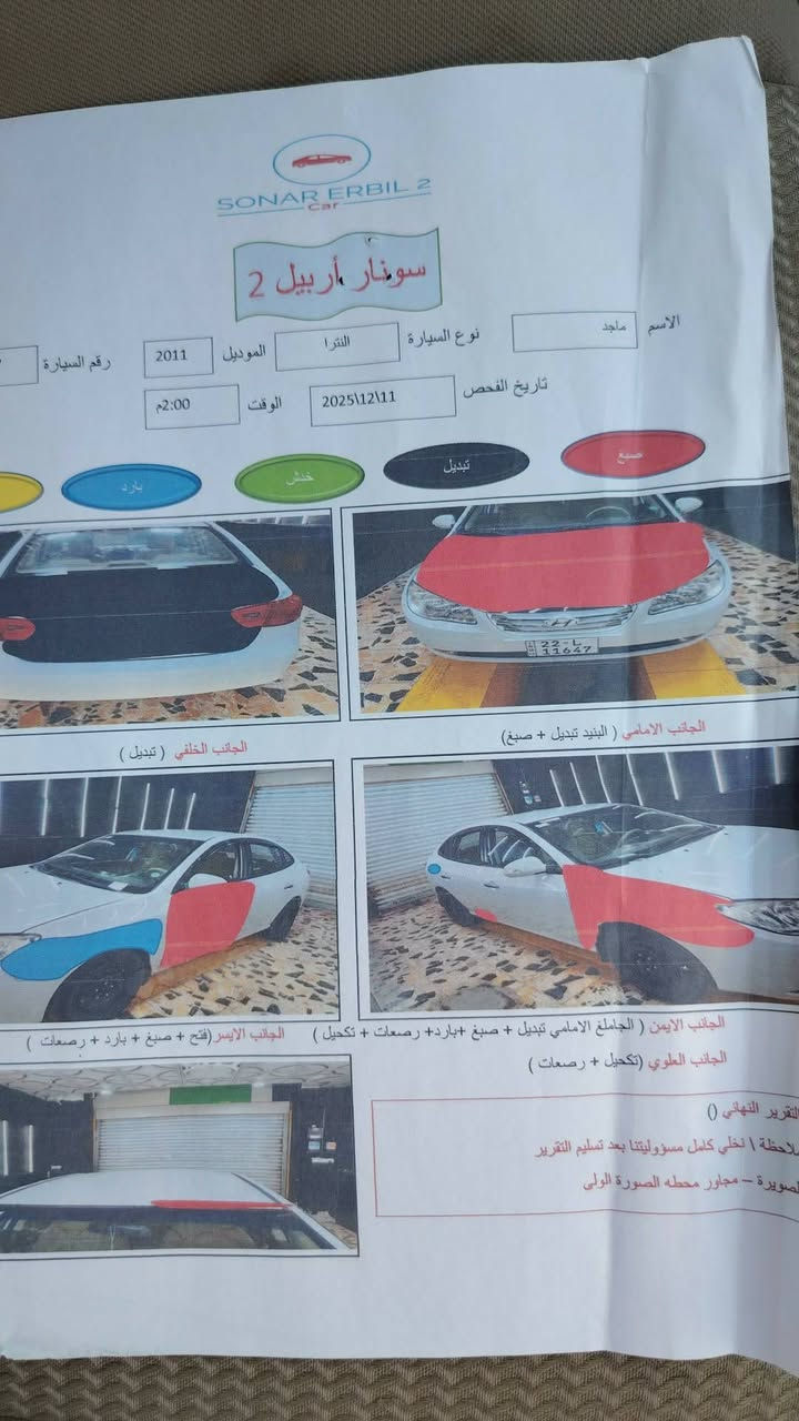 السلام عليكم
النترا خليجي موديل ١١ رقم أربيل محرك ١٦٠٠ بيها ٤ قطع تبديل وصبغ سيارة جاهزه ومابيها نقص تخم تاير حدادية جيده جدا مواصفات عاديه ٤ دسك اشاير بالمري مشط كهربائي شاشة وكاميرا
تحويل وكاله باليعجبك سنويه لل٣١ السعر ٨٨ وبيها مجال مكان السيارة واسط الشحيمية او الزبيدية السونار مرفق مع الصور 
***********
